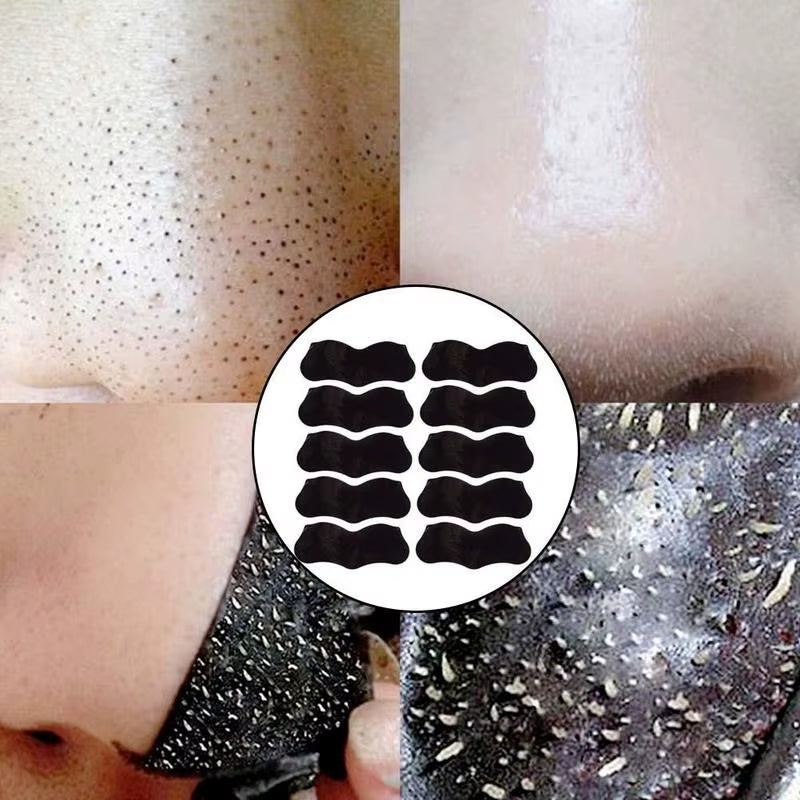 10-100Pcs Nose Blackhead Remover Mask Deep Cleansing Skin Care Shrink Pore Acne Treatment Mask Nose Black Dots Pore Clean Strips