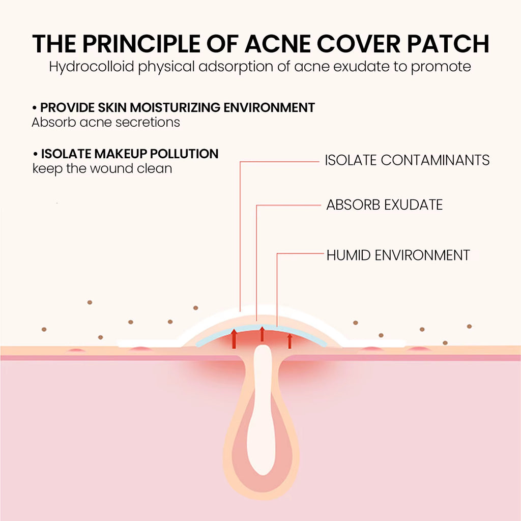 Repair Acne Patch Facial Skin Care Fade Blemishes Pimple Marks Closed Acne Blemishes Cover Acne Pimple Repair Patch