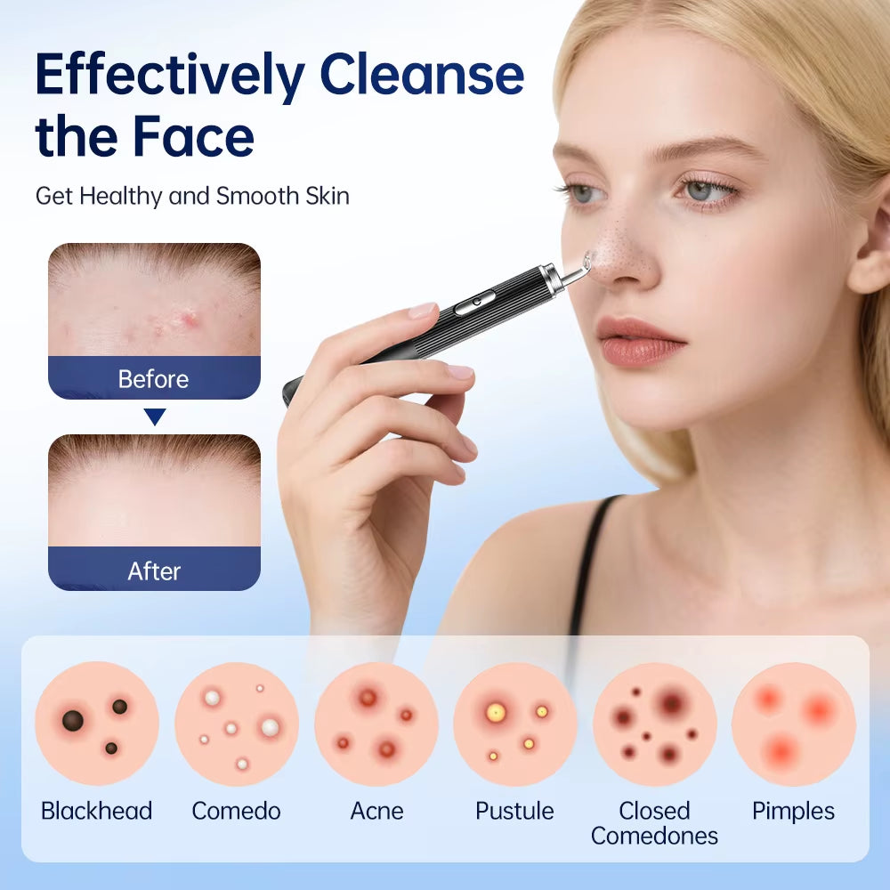 Visual Blackhead Remover HD Camera 50X Magnification Acne Pore Cleaner with LED Light Pimple Extractor Tool Kit Deep Cleaning