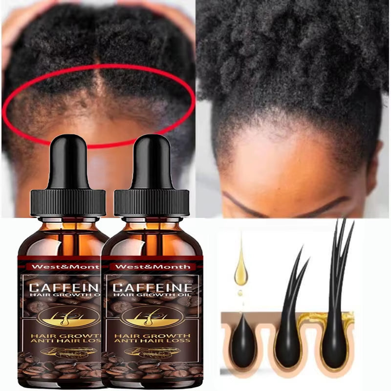 Caffeine Hair Growth Essential Oil Hair Loss Preventation Nourishing Hair Roots Hair Repair Treatment Oil Promote Hair Growth