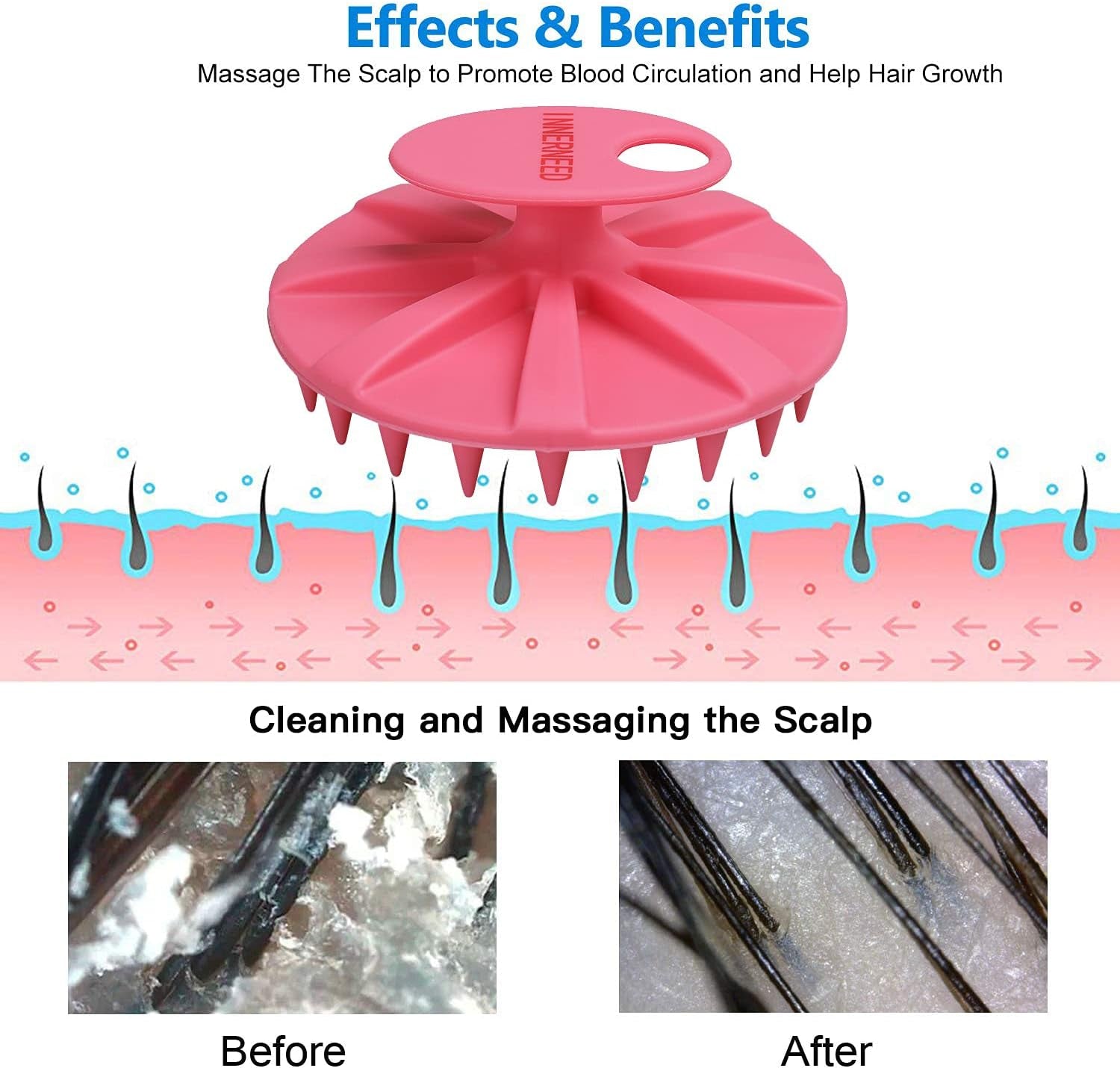 Scalp Massager Shampoo Brush, Wet & Dry Manual Scalp Care Head Scrubber Hair Washing, Soft Silicone Bristles, for Hair Growth, Dandruff Removal, Comfortable for All Hair Types (Pink)