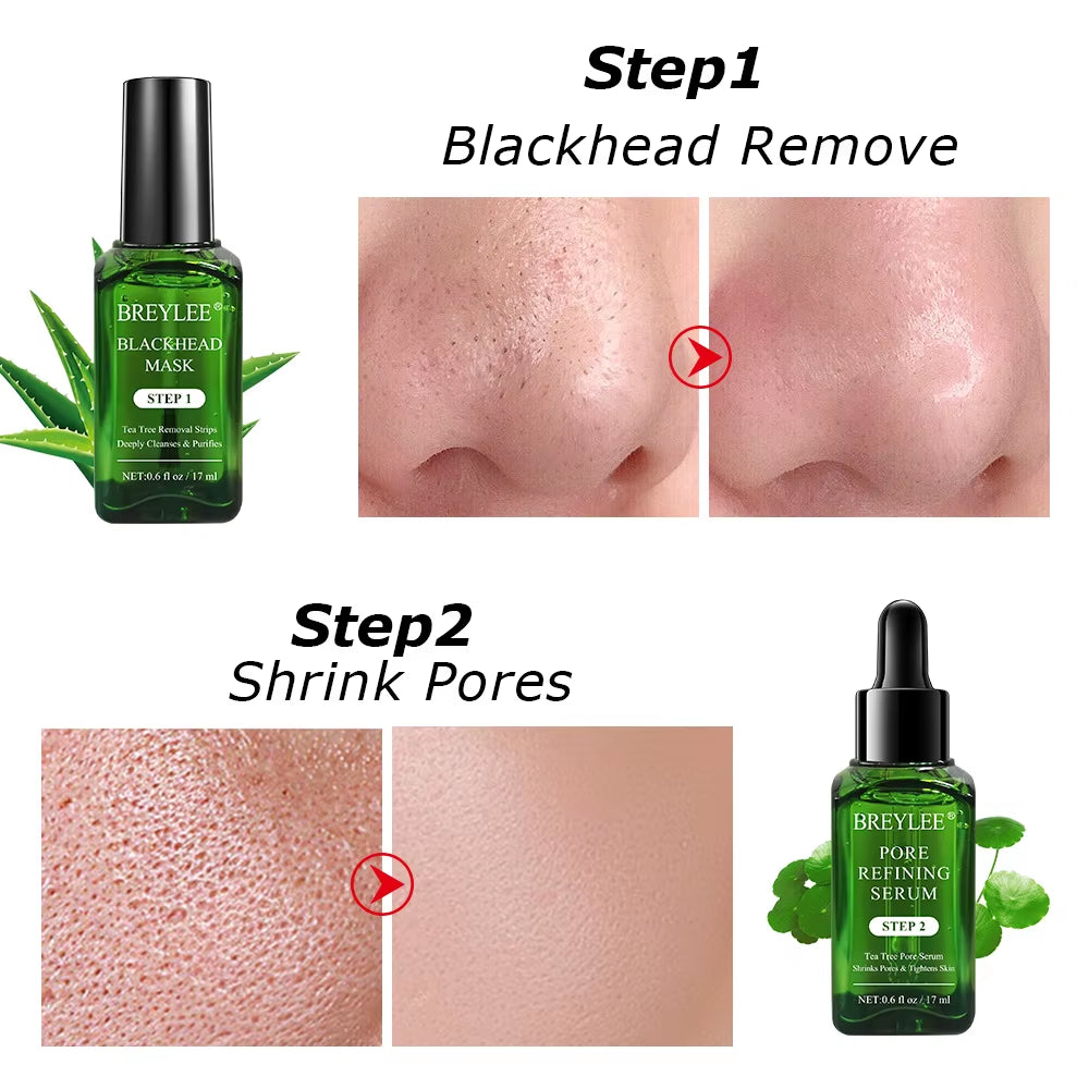 Blackhead Removing Kit Pore Refining Blackhead Remover Serum Acne Treatment Shrinks Pore Peel off Facial Cream Skin Care