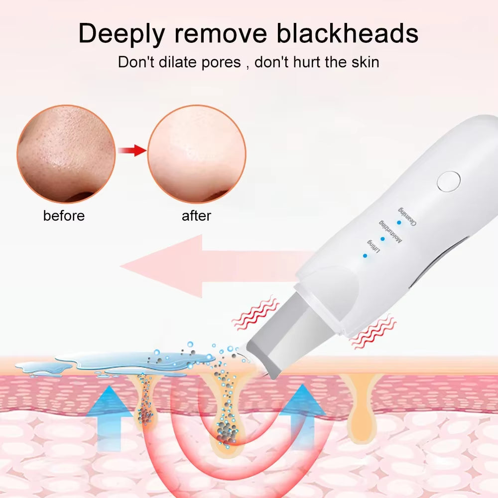 Blackhead Remover Deep Facial Cleansing Spatula Face Cleaning Lift Machine Peeling Shovel Pore Cleaner Black Dot Sebum Remover