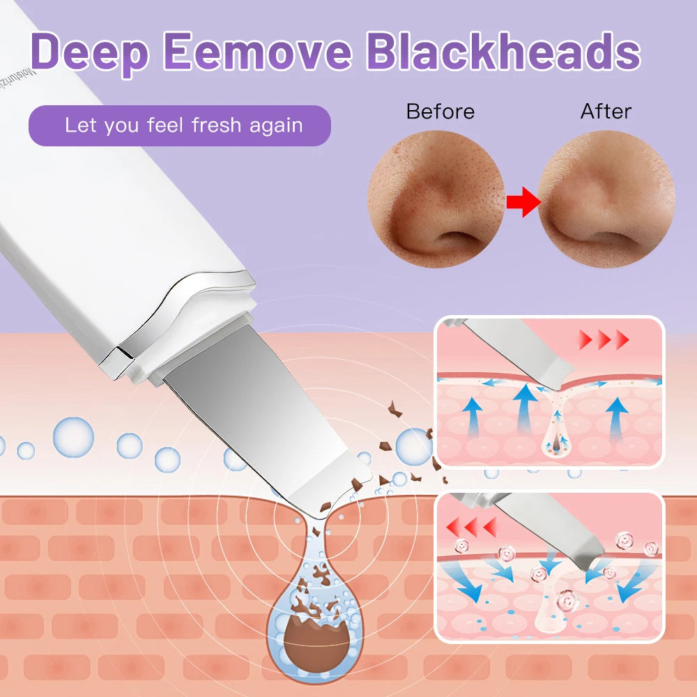 Ultrasonic Peeling Machine Skin Care Blackhead Remover Device Face Cleaning Pore Cleanser Facial Lifting Massager Skin Scrubber