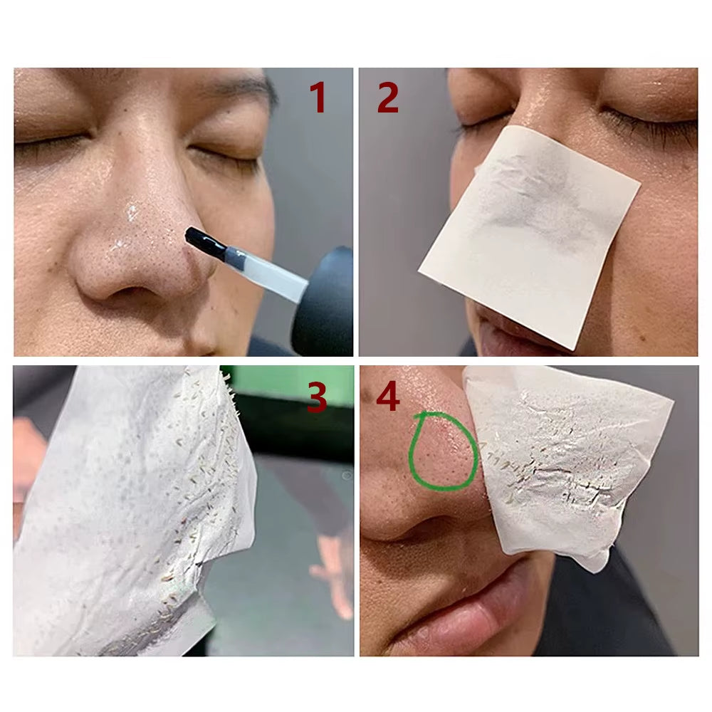 Blackhead Removing Kit Pore Refining Blackhead Remover Serum Acne Treatment Shrinks Pore Peel off Facial Cream Skin Care