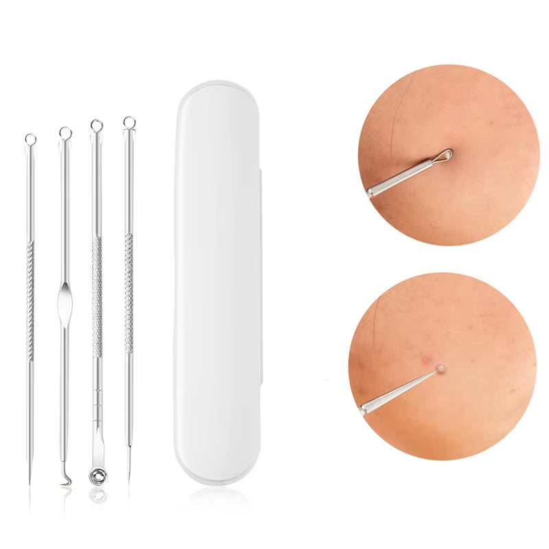 Sliver Gold Blackhead Comedone Acne Pimple Belmish Extractor Vacuum Blackhead Remover Clean Tool Spoon for Face Skin Care Tool