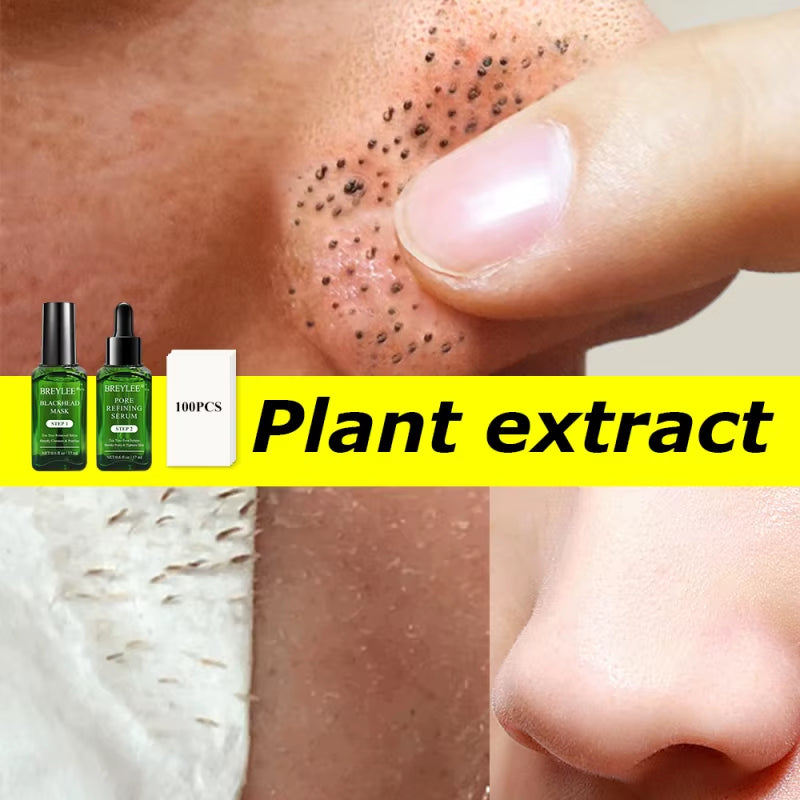 Blackhead Removing Kit Pore Refining Blackhead Remover Serum Acne Treatment Shrinks Pore Peel off Facial Cream Skin Care