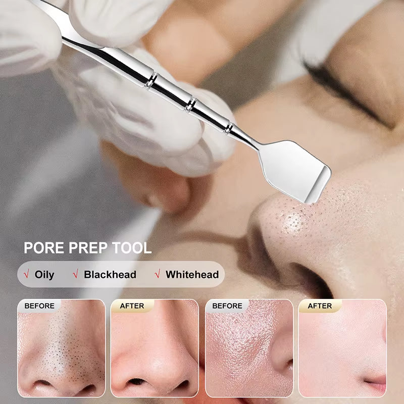 Two-Sided Blackhead Remover Spatula Nose Face Blemish Pore Cleaner Blackhead Clip Tweezers Beauty Face Health Salon Tool