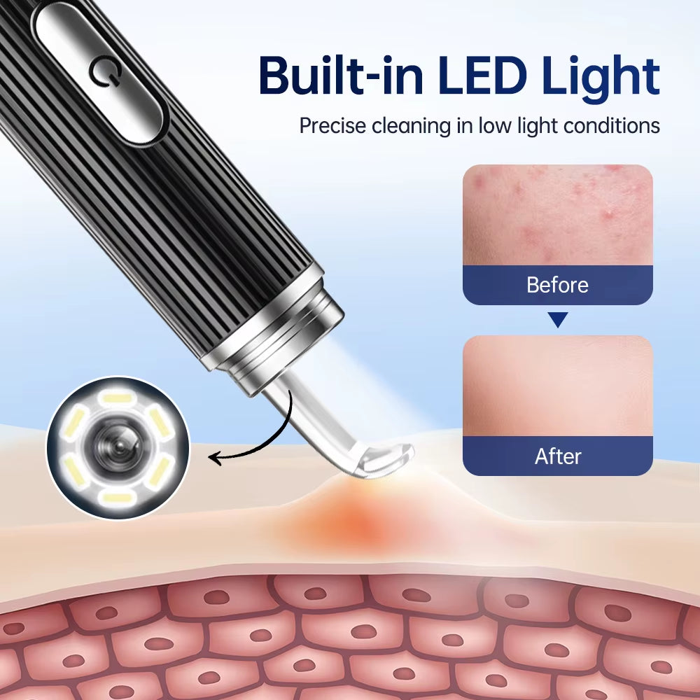 Visual Blackhead Remover HD Camera 50X Magnification Acne Pore Cleaner with LED Light Pimple Extractor Tool Kit Deep Cleaning