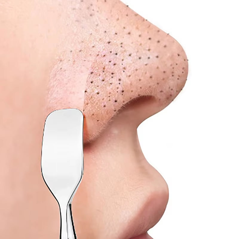 Double Head Stainless Steel Professional Blackhead Remover Blemish Extractor Tool Pimple Comedone Removal for Face