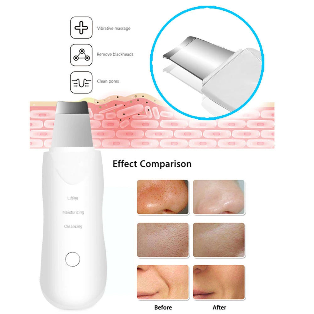 Vibration Facial Massage Skin Scrubber Cleaner Ion Acne Blackhead Remover Peeling Shovel Cleaner Facial Massager Skin Care