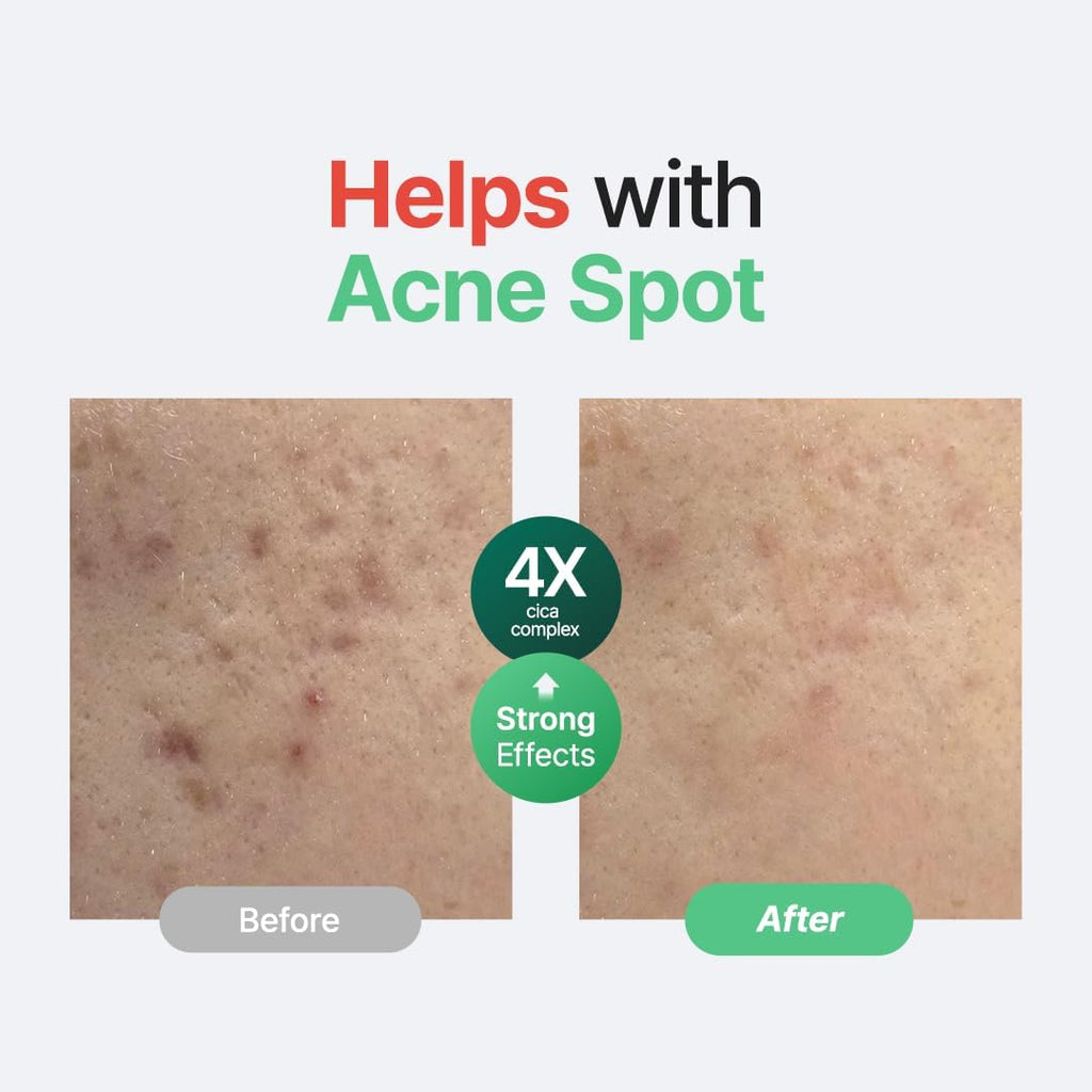 SEOUL Wonder Releaf Centella Serum Unscented, Korean Centella, for Sensitive Skin, Ampoule, Soothing, Facial Serum for Face, K-Beauty, 60Ml 2Fl.Oz