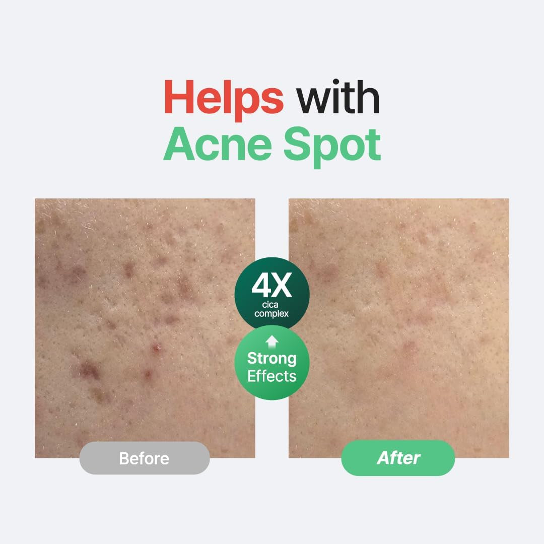 SEOUL Wonder Releaf Centella Serum Unscented, Korean Centella, for Sensitive Skin, Ampoule, Soothing, Facial Serum for Face, K-Beauty, 60Ml 2Fl.Oz