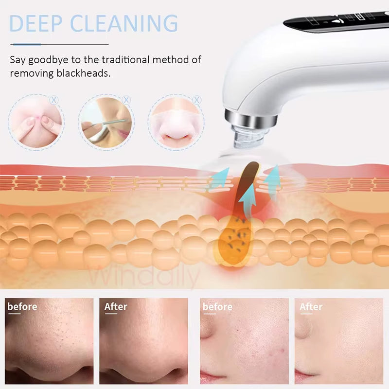 2025 Blackhead Remover Pore Vacuum Cleaner Electric Micro Small Bubble Facial Cleasing Machine USB Rechargeable Beauty Device