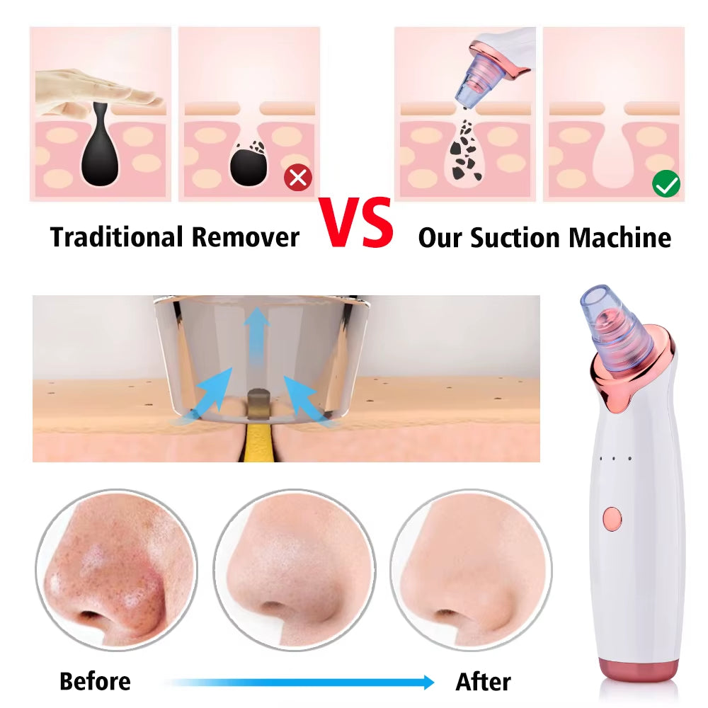 Electric Vacuum Suction Blackhead Remover USB Rechargeable Facial Pore Acne Cleaner Comedone Spot Ore Cleansing Pimple Extractor